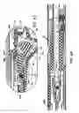 Fig. 32 - Surgical Stapling Apparatus Having Articulation Mechanism