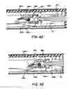 Fig. 40 - Surgical Stapling Apparatus Having Articulation Mechanism