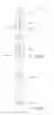 Fig. 09 - Transmission of a control force