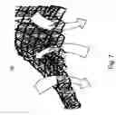 Fig. 06 - Modular passenger seat for an aircraft