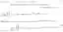 Fig. 05 - Line of response estimation for high-resolution PET detector