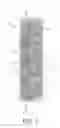Fig. 02 - Device comprising means for guiding fluid from an inlet to an outlet