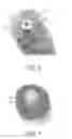 Fig. 04 - Device comprising means for guiding fluid from an inlet to an outlet