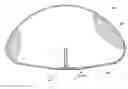 Fig. 01 - Method of formation of a medical implant