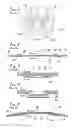 Fig. 02 - Method of formation of a medical implant