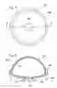 Fig. 04 - Method of formation of a medical implant