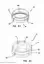 Fig. 08 - RING SEAL RETAINER ASSEMBLY AND METHODS