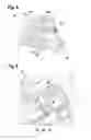 Fig. 04 - Displacement drive, in particular window lifter drive