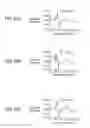 Fig. 19 - Elastic wave element, and electrical apparatus and duplexer using same