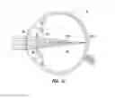 Fig. 03 - PUPIL DEPENDENT DIFFRACTIVE LENS FOR NEAR, INTERMEDIATE, AND FAR VISION