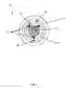 Fig. 02 - Dynamic Changeable Focus Contact And Intraocular Lens