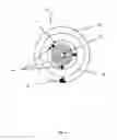 Fig. 05 - Dynamic Changeable Focus Contact And Intraocular Lens