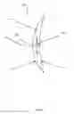 Fig. 06 - Dynamic Changeable Focus Contact And Intraocular Lens