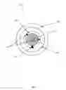 Fig. 08 - Dynamic Changeable Focus Contact And Intraocular Lens