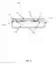 Fig. 12 - Dynamic Changeable Focus Contact And Intraocular Lens