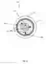 Fig. 13 - Dynamic Changeable Focus Contact And Intraocular Lens