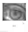 Fig. 09 - Scanning and processing using optical coherence tomography