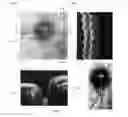 Fig. 04 - Method of motion correction in optical coherence tomography imaging