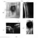 Fig. 05 - Method of motion correction in optical coherence tomography imaging