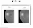 Fig. 10 - Imaging control apparatus for capturing tomogram of fundus, imaging apparatus, imaging control method, program, and storage medium