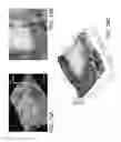 Fig. 18 - Non-contact surface characterization using modulated illumination