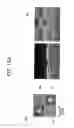 Fig. 12 - METHOD FOR FABRICATING MICRO-LENS, AND MICRO-LENS ARRAY INCLUDING THE MICRO-LENS