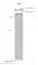 Fig. 02 - FUEL ROD AND FUEL ASSEMBLY