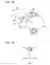 Fig. 03 - Hearing aid