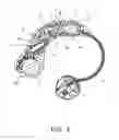 Fig. 05 - Hearing aid