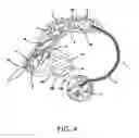 Fig. 06 - Hearing aid