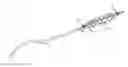 Fig. 01 - Deformable motion correction for stent visibility enhancement