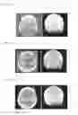 Fig. 03 - Method and device for processing 3-D image data of a skull