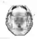 Fig. 06 - Method and device for processing 3-D image data of a skull