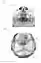 Fig. 07 - Method and device for processing 3-D image data of a skull