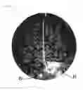 Fig. 08 - Method and device for processing 3-D image data of a skull