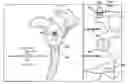 Fig. 01 - System of preoperative planning and provision of patient-specific surgical aids