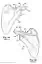 Fig. 02 - System of preoperative planning and provision of patient-specific surgical aids