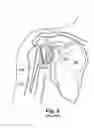 Fig. 04 - System of preoperative planning and provision of patient-specific surgical aids