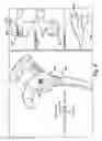 Fig. 06 - System of preoperative planning and provision of patient-specific surgical aids