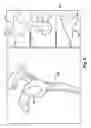 Fig. 08 - System of preoperative planning and provision of patient-specific surgical aids
