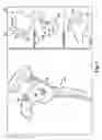 Fig. 09 - System of preoperative planning and provision of patient-specific surgical aids