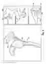 Fig. 10 - System of preoperative planning and provision of patient-specific surgical aids