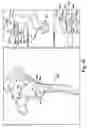 Fig. 12 - System of preoperative planning and provision of patient-specific surgical aids