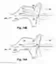Fig. 16 - System of preoperative planning and provision of patient-specific surgical aids
