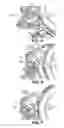 Fig. 04 - DISENGAGING AN IMAGING MEMBER FROM A PHOTOCONDUCTOR