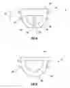 Fig. 03 - Expansion Joint