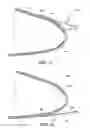 Fig. 04 - Integrated lightning receptor system and trailing edge noise reducer for a wind turbine rotor blade
