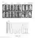 Fig. 12 - Antibodies and methods of use thereof