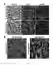 Fig. 12 - Compositions and methods for treating cancer