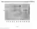 Fig. 24 - Compositions and methods for treating cancer
